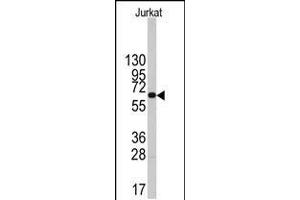 Western blot analysis of anti-PFKFB1 Antibody in Jurkat cell line lysates (35ug/lane). (PFKFB1 抗体  (AA 259-289))