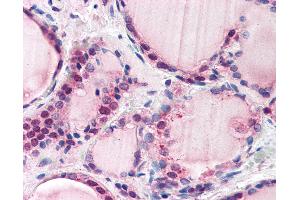 Anti-FBXL3 antibody IHC of human thyroid. (FBXL3 抗体  (AA 2-15))