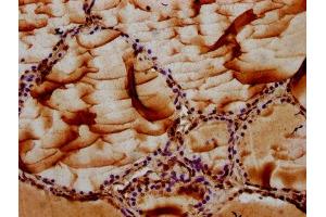 IHC image of ABIN7151913 diluted at 1:100 and staining in paraffin-embedded human thyroid tissue performed on a Leica BondTM system.