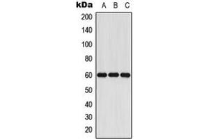 Western Blotting (WB) image for anti-Cytochrome P450, Family 11, Subfamily A, Polypeptide 1 (CYP11A1) (C-Term) antibody (ABIN7295466)