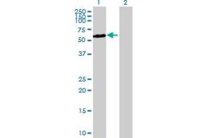 Western Blot analysis of CDKL3 expression in transfected 293T cell line by CDKL3 MaxPab polyclonal antibody. (CDKL3 抗体  (AA 1-592))