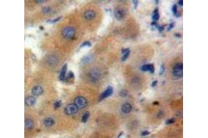 Used in DAB staining on fromalin fixed paraffin-embedded Liver tissue (ARTN 抗体  (AA 112-224))