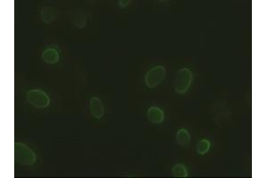 Anti-SOX17 mouse monoclonal antibody (ABIN2452368) immunofluorescent staining of HeLa cells transiently transfected by pCMV6-ENTRY SOX17 (RC220888) (SOX17 抗体  (AA 177-414))