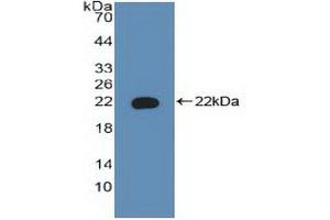Western blot analysis of recombinant Human BAD. (BAD 抗体  (AA 1-168))