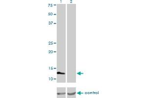 Western blot analysis of FABP3 over-expressed 293 cell line, cotransfected with FABP3 Validated Chimera RNAi (Lane 2) or non-transfected control (Lane 1). (FABP3 抗体  (AA 1-133))