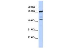 Image no. 1 for anti-Sex Comb On Midleg-Like 4 (SCML4) (AA 72-121) antibody (ABIN6740386) (SCML4 抗体  (AA 72-121))