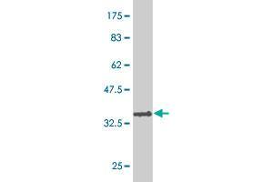 Western Blot detection against Immunogen (36. (TFDP3 抗体  (AA 1-100))