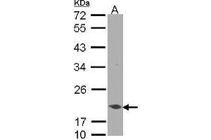 WB Image Sample(30 μg of whole cell lysate) A:A431, 12% SDS PAGE antibody diluted at 1:1000