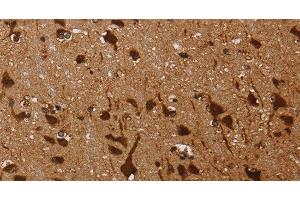 Immunohistochemistry of paraffin-embedded Human brain using KARS Polyclonal Antibody at dilution of 1:60 (KARS 抗体)