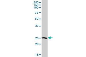 DCXR MaxPab polyclonal antibody. (DCXR 抗体  (AA 1-244))