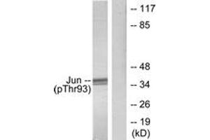 Western blot analysis of extracts from HeLa cells treated with UV, using c-Jun (Phospho-Thr93) Antibody. (C-JUN 抗体  (pThr93))