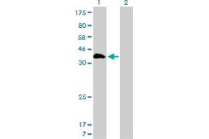 Western Blot analysis of HOXA11 expression in transfected 293T cell line by HOXA11 monoclonal antibody (M01), clone 7E12. (Homeobox A11 抗体  (AA 60-166))