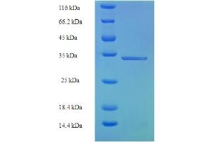SDS-PAGE (SDS) image for Ubiquitin D (UBD) (AA 1-165), (full length) protein (His-SUMO Tag) (ABIN5710581)