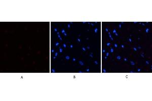 Immunofluorescence analysis of rat heart tissue. (PERK 抗体  (pThr981))