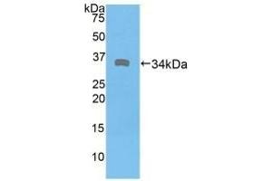 Detection of Recombinant DMD, Human using Polyclonal Antibody to Dystrophin (DMD) (Dystrophin 抗体  (AA 3048-3328))