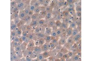 Used in DAB staining on fromalin fixed paraffin- embedded liver tissue (HMGCL 抗体  (AA 1-325))