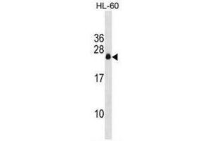 APRG1 Antibody (Center) western blot analysis in HL-60 cell line lysates (35µg/lane). (C3ORF35 抗体  (Middle Region))