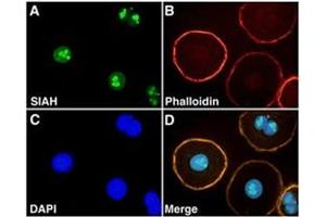 Immunofluorescence staining of SIAH2 on NIH : OVCAR-3 with SIAH2 monoclonal antibody, clone 24E6H3 . (SIAH2 抗体  (AA 1-100))