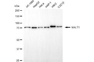Western blotting analysis using MALT1 antibody (ABIN7799490).