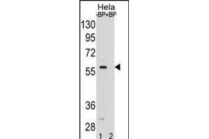 SD5 Antibody (Center) (ABIN1881816 and ABIN2838794) pre-incubated without(lane 1) and with(lane 2) blocking peptide in Hela cell line lysate. (SMAD5 抗体  (AA 241-269))