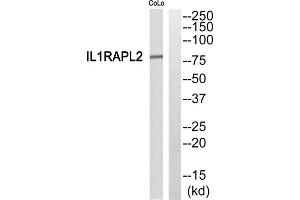 Western blot analysis of extracts from COLO205 cells, using IL1RAPL2 antibody. (IL1RAPL2 抗体  (Internal Region))