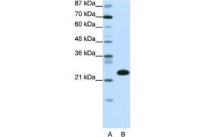 Western Blotting (WB) image for anti-TATA Box Binding Protein Associated Factor 11 (TAF11) antibody (ABIN2460381) (TAF11 抗体)