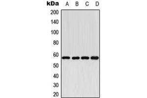 Western blot analysis of Cytochrome P450 2E1 expression in HEK293T (A), NIH3T3 (B), H9C2 (C), Human Liver (D) whole cell lysates. (CYP2E1 抗体  (C-Term))