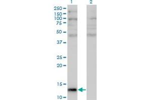 Western Blot analysis of ANG expression in transfected 293T cell line by ANG monoclonal antibody (M05), clone 2A7. (ANG 抗体  (AA 25-147))