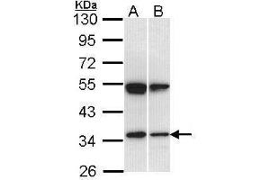 WB Image Sample (30 ug of whole cell lysate) A: Hep G2 , B: Raji 10% SDS PAGE antibody diluted at 1:1000 (SH3GL1 抗体  (Center))