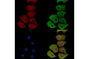 ABIN6259695 and ABIN6278366 staining Hela cells by IF/ICC.