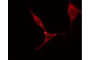 ABIN6275782 staining Hela cells by IF/ICC. (MYL6 抗体  (Internal Region))