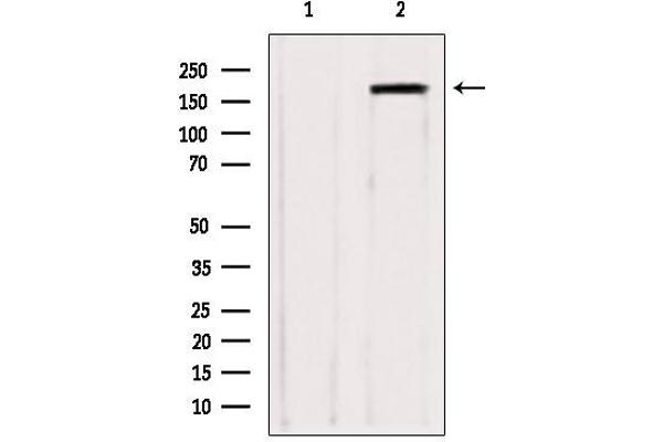 ZCCHC11 抗体  (Internal Region)