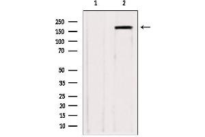 Western blot analysis of extracts from various samples, using ZCCHC11 antibody. (ZCCHC11 抗体  (Internal Region))