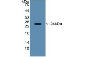 Detection of Recombinant NCL, Human using Polyclonal Antibody to Nucleolin (NCL) (Nucleolin 抗体  (AA 388-569))