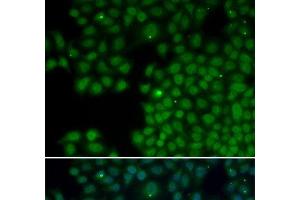 Immunofluorescence analysis of HeLa cells using NUDT6 Polyclonal Antibody (NUDT6 抗体)