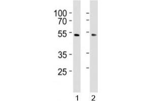 Western blot analysis of lysate from 1) HepG2 and 2) HUVEC cell line using SUV39H2 antibody at 1:1000. (SUV39H2 抗体  (AA 93-122))