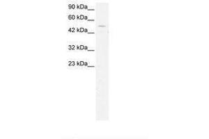 Image no. 3 for anti-General Transcription Factor IIH, Polypeptide 1, 62kDa (GTF2H1) (N-Term) antibody (ABIN202744) (GTF2H1 抗体  (N-Term))