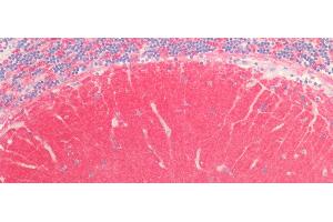 Detection of SYT1 in Human Cerebellum Tissue using Polyclonal Antibody to Synaptotagmin I (SYT1) (SYT1 抗体  (AA 136-422))
