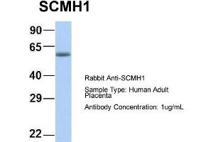 Host: Rabbit Target Name: CHAD Sample Type: Human Adult Placenta Antibody Dilution: 1. (SCMH1 抗体  (Middle Region))