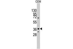 Western blot analysis of PITX2 polyclonal antibody  in CEM cell line lysates (35 ug/lane). (PITX2 抗体  (C-Term))