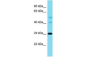 Host:  Rabbit  Target Name:  RNF149  Sample Type:  Lung Tumor lysates  Antibody Dilution:  1. (RNF149 抗体  (C-Term))