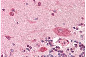 Human Brain, Cerebellum (formalin-fixed, paraffin-embedded) stained with PDPN antibody ABIN364350 at 5 ug/ml followed by biotinylated anti-mouse IgG secondary antibody ABIN481714, alkaline phosphatase-streptavidin and chromogen. (Podoplanin 抗体  (AA 1-206))