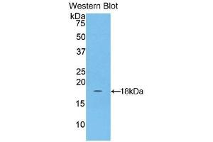 Detection of Recombinant ACP, Human using Polyclonal Antibody to Acyl Carrier Protein, Mitochondrial (ACP) (NDUFAB1 抗体  (AA 5-129))