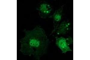 Anti-CTNNB1 mouse monoclonal antibody (ABIN2454167) immunofluorescent staining of COS7 cells transiently transfected by pCMV6-ENTRY CTNNB1 (RC208947). (CTNNB1 抗体)
