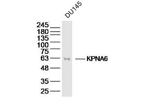 DU145 lysates probed with KPNA6 Polyclonal Antibody, Unconjugated  at 1:300 dilution and 4˚C overnight incubation. (KPNA6 抗体  (AA 101-200))