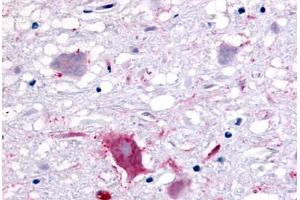 Anti-GPR32 antibody  ABIN1048800 IHC staining of human brain, neurons and glia.