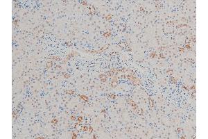 Immunohistochemistry (IHC) image for anti-Cofilin 1 (CFL1) (pSer3) antibody (ABIN6255180)