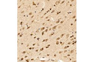 Immunohistochemistry (Paraffin-embedded Sections) (IHC (p)) image for anti-Src Homology 2 Domain Containing F (SHF) antibody (ABIN7075710)