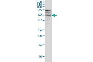 Western Blotting (WB) image for anti-SPARC Related Modular Calcium Binding 1 (SMOC1) (AA 150-221) antibody (ABIN566231)