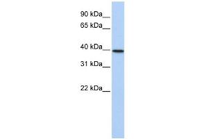 TIA1 antibody used at 1 ug/ml to detect target protein. (TIA1 抗体  (N-Term))